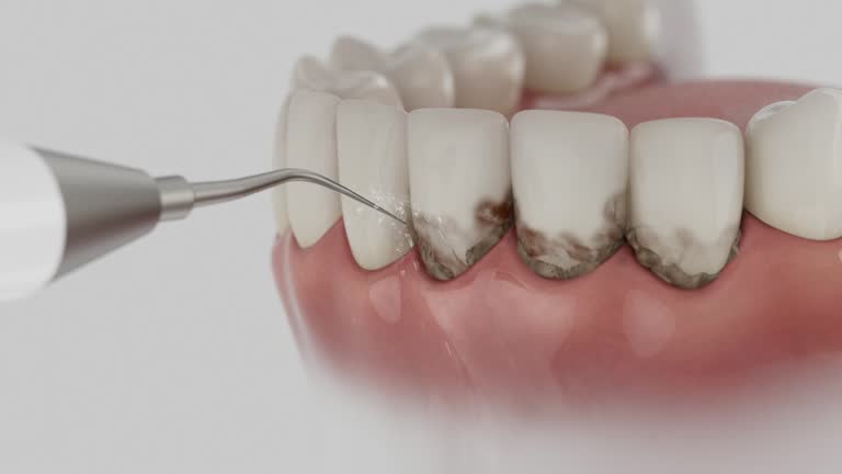 Reliable Root Canal Treatment contractor in Wood County County, OH by Dentist Open Now